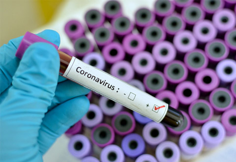 coronavirus evidenza provetta