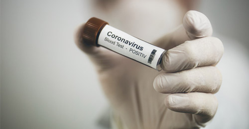 coronavirus provetta 03 fb