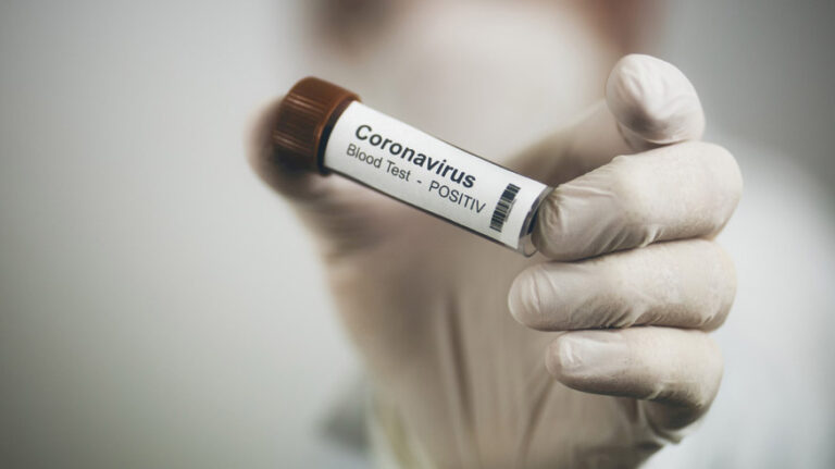 coronavirus provetta 03 ok