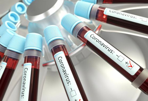 coronavirus positivo evidenza